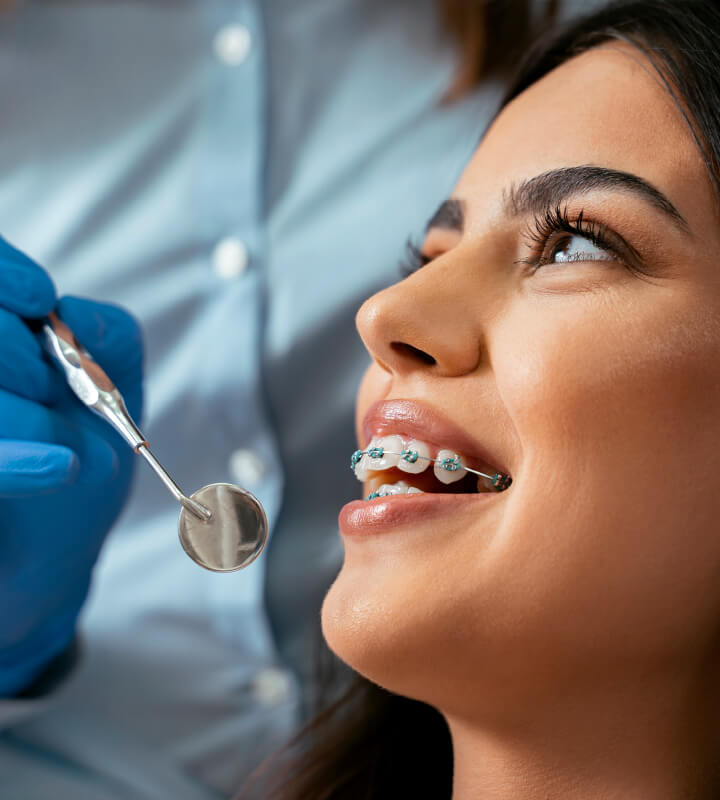 Aparat Dentar