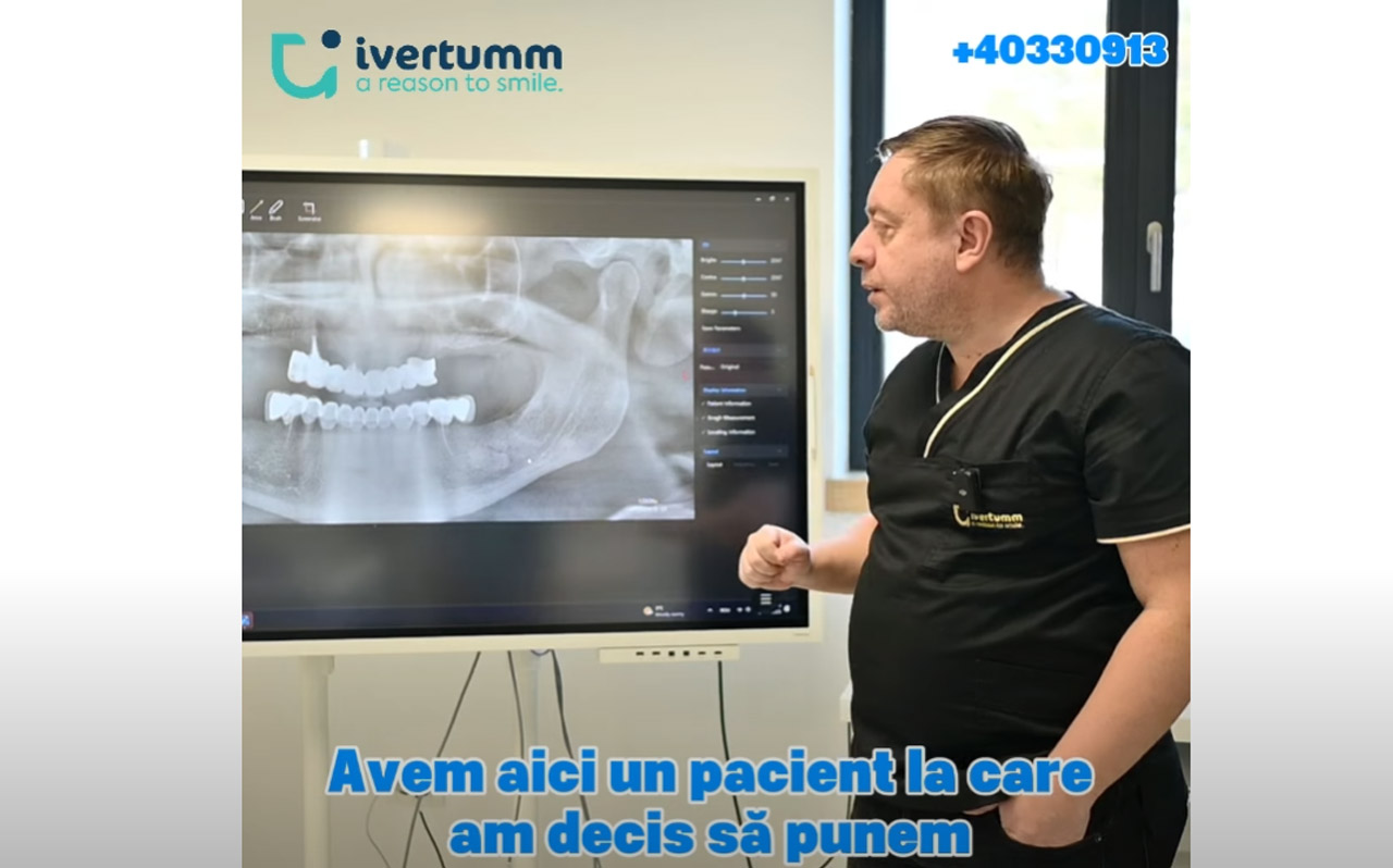 Ivertumm