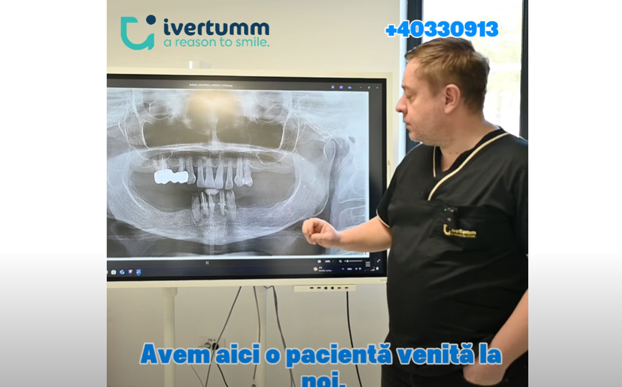 Ivertumm